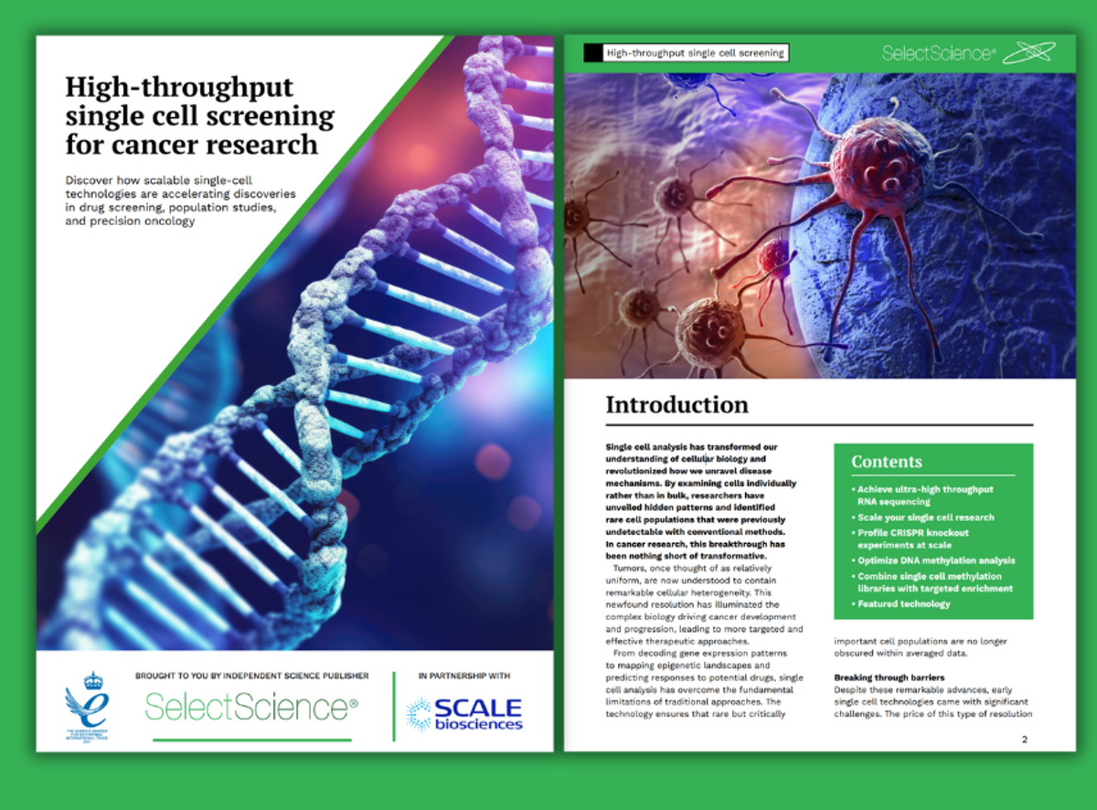 Buy Single Cell RNA Sequencing Kit Read Reviews