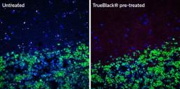 Human cerebral cortex tissue