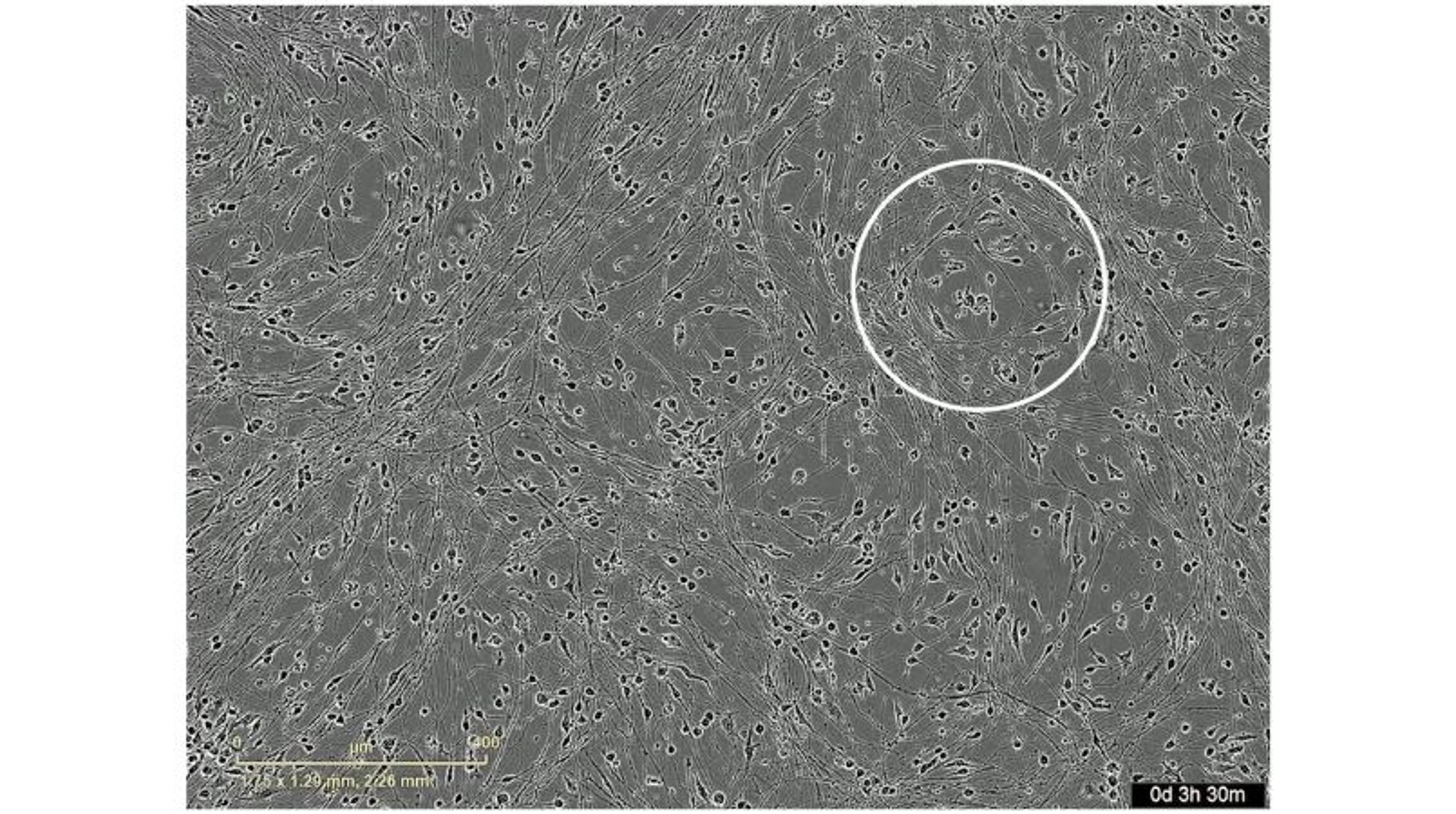 ioMicroglia in coculture with ioGlutamatergic Neurons ioMicroglia in coculture with ioGlutamatergic Neurons