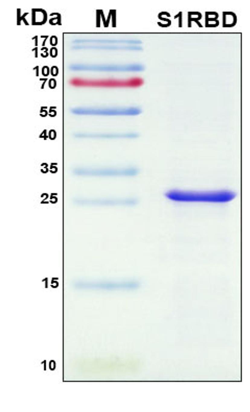 SDS-PAGE