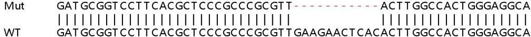 Sanger Seq - CBS knockout HeLa