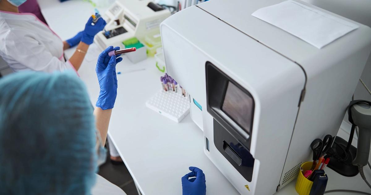 Evolving allergy testing technologies in clinical labs - SelectScience news