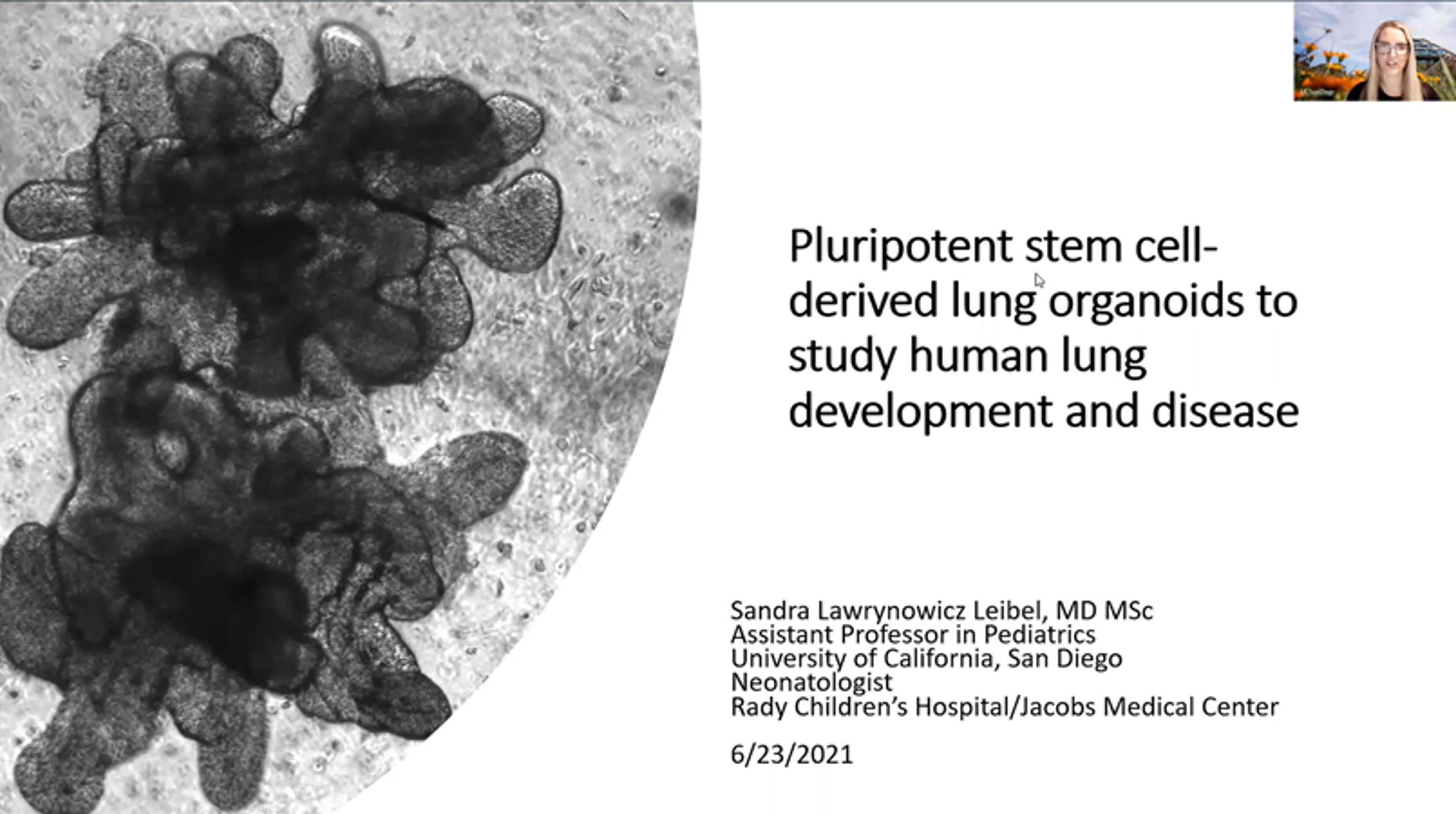 Pluripotent stem cell-derived lung organoids to study human lung development and disease Pluripotent stem cell-derived lung organoids to study human lung development and disease