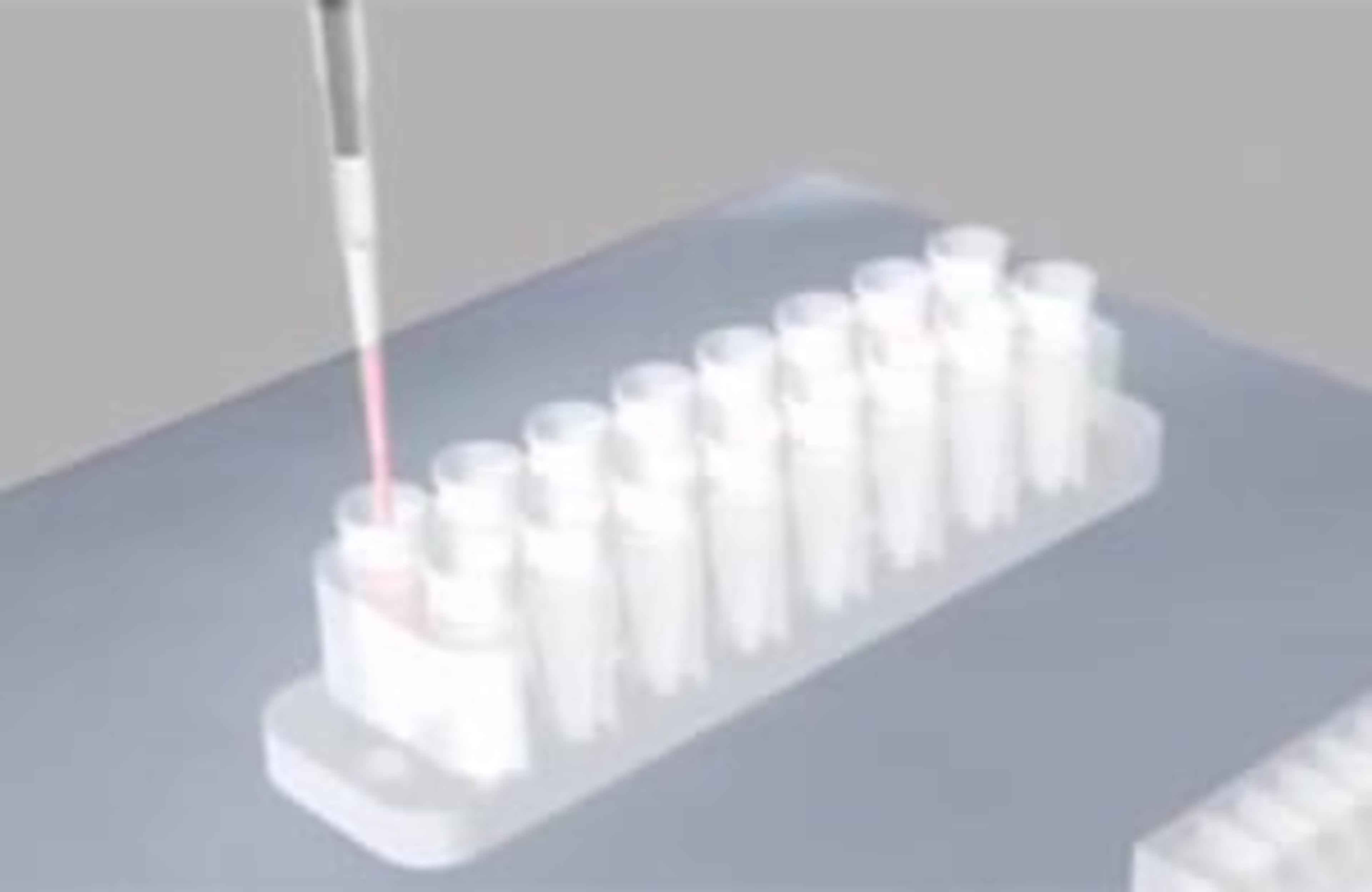 The VenaT4™ Biochip from Cellix for Chemotaxis, Transmigration and Invasion Assays The VenaT4™ Biochip from Cellix for Chemotaxis, Transmigration and Invasion Assays