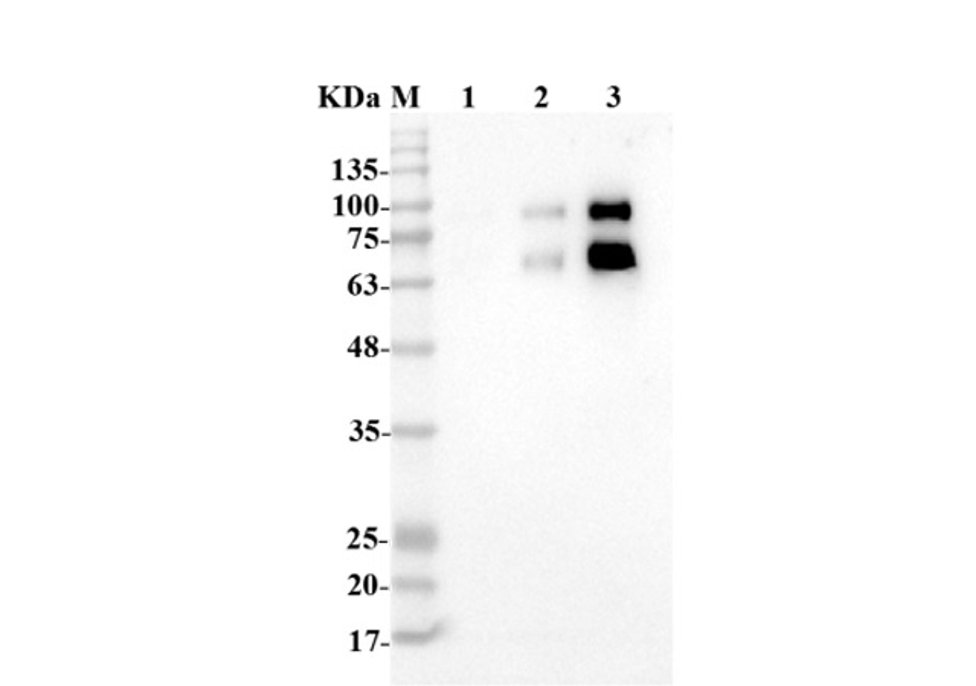 Anti-Human ENG Recombinant Antibody (TAB-013ML)