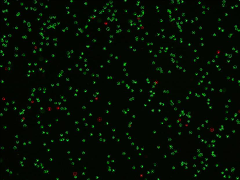 Image of fluorescent green and red cells on a black background