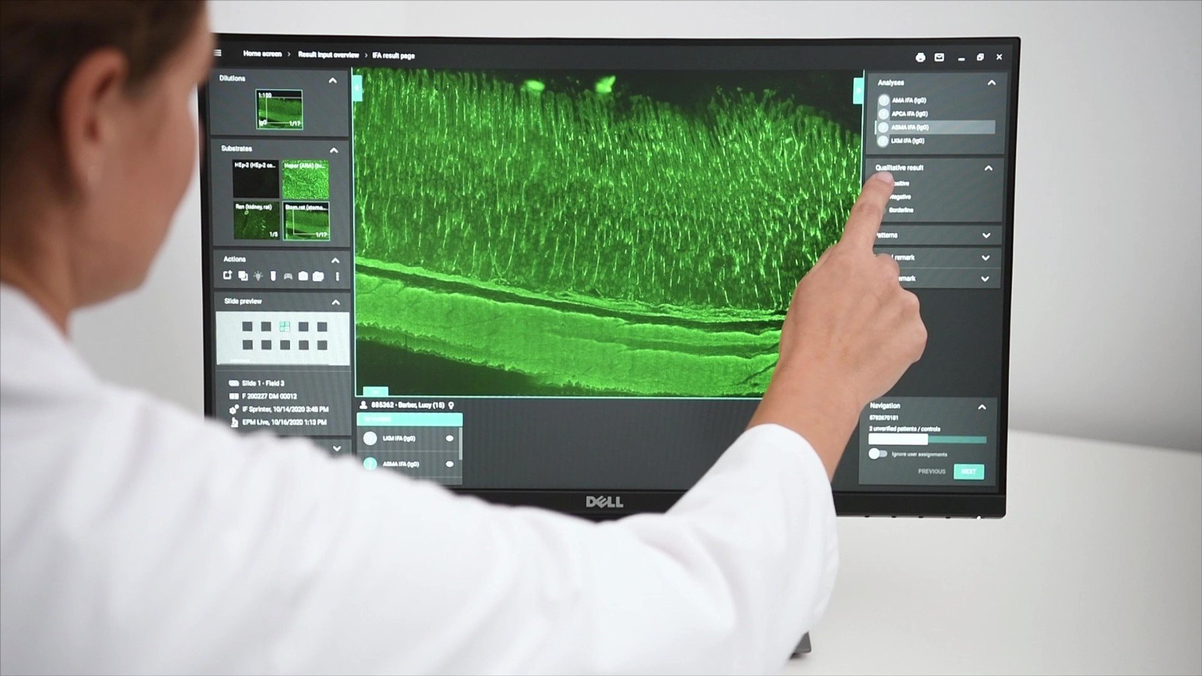 EUROPattern Microscope Live: Ultrafast immunofluorescence microscopy EUROPattern Microscope Live: Ultrafast immunofluorescence microscopy