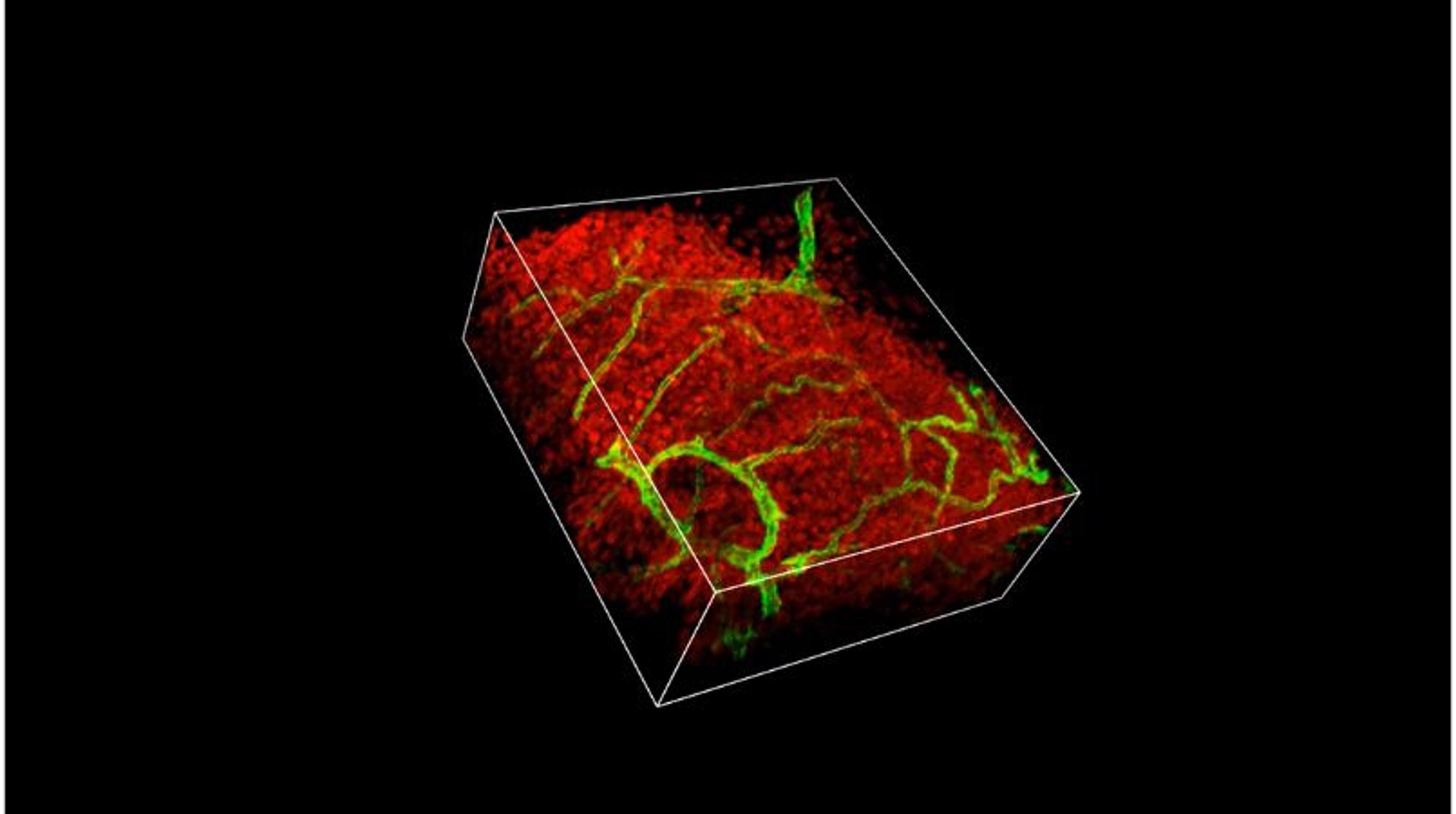 DeepSIM acquisition of a cleared mouse intestine section DeepSIM acquisition of a cleared mouse intestine section