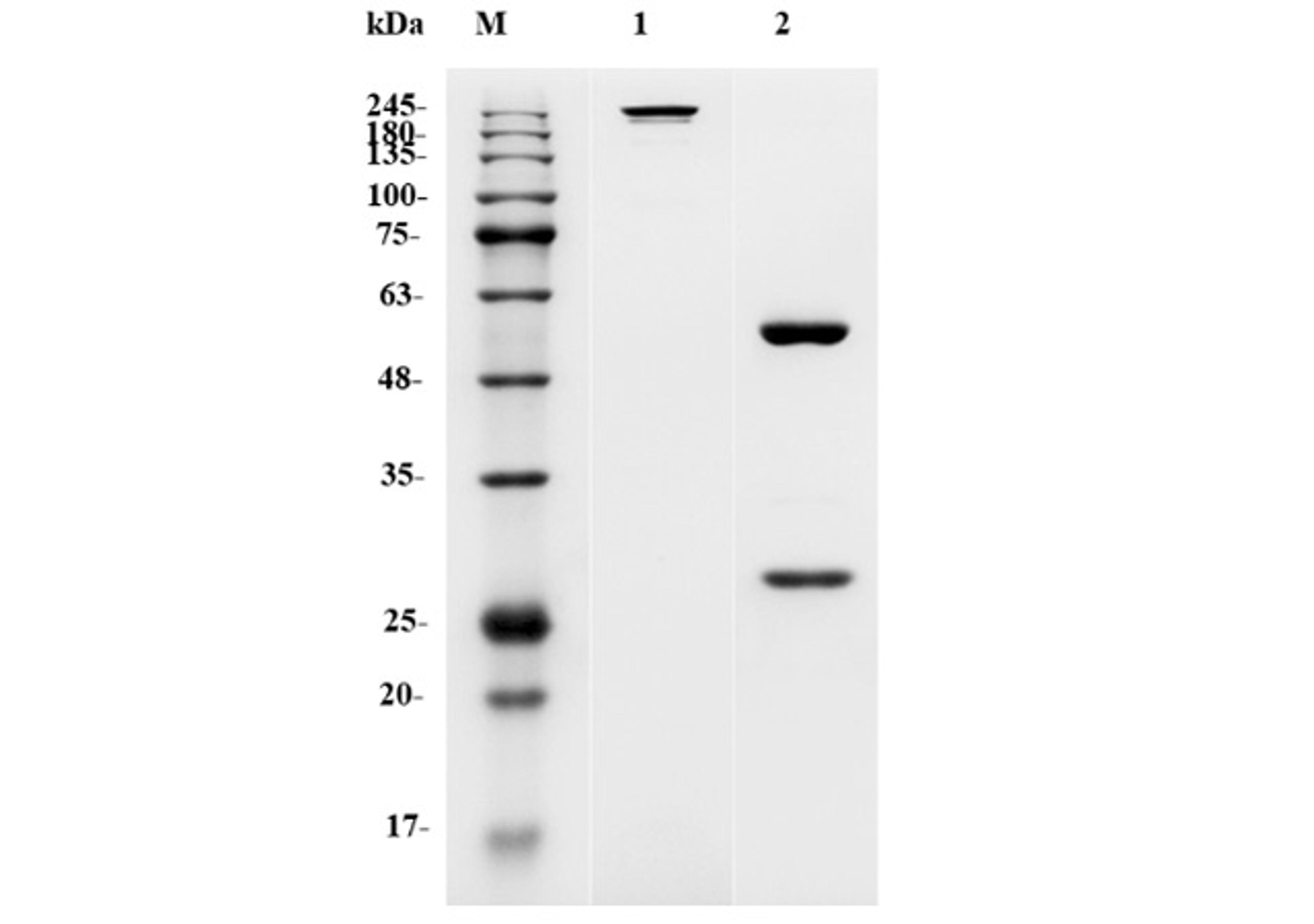 Anti-Human IL5RA Recombinant Antibody (TAB-222)