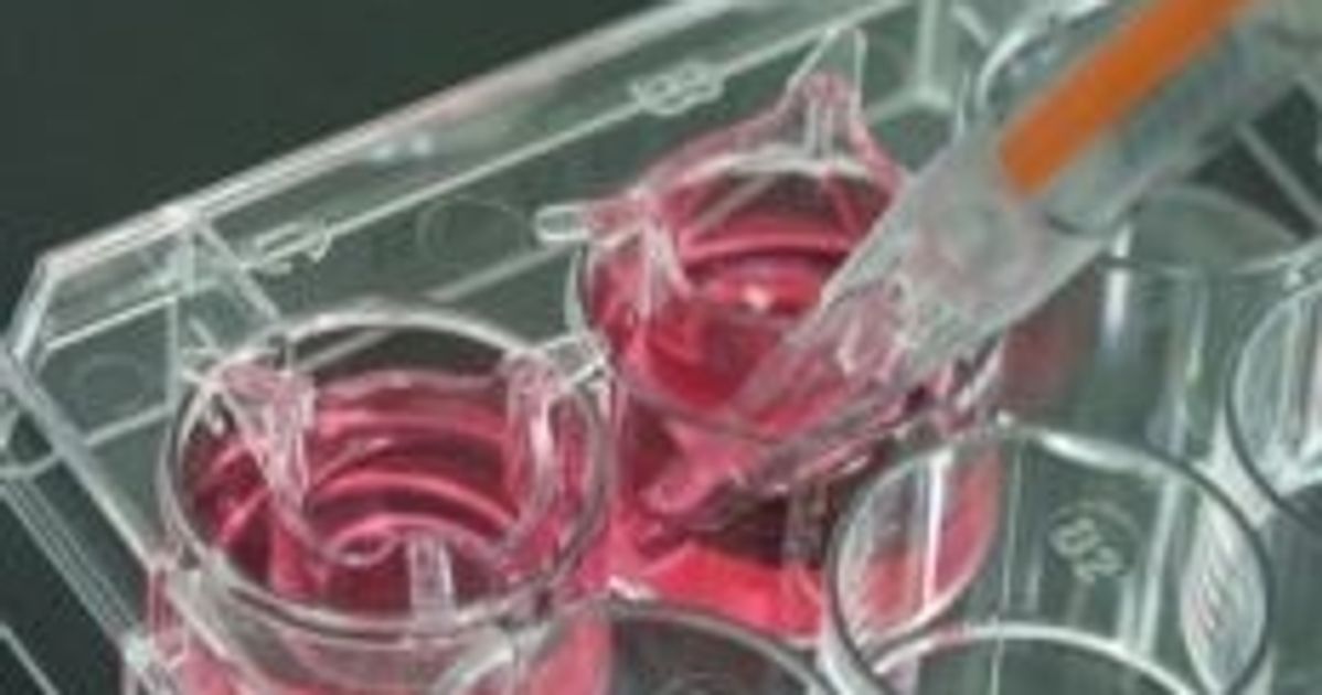ThinCert Cell Culture Inserts from Greiner Bio-One Offer Alternative to ...