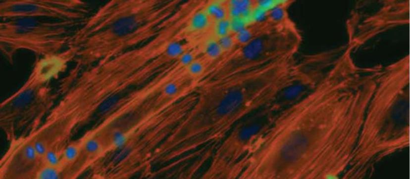 CAR T cell therapy development with microfluidic technology