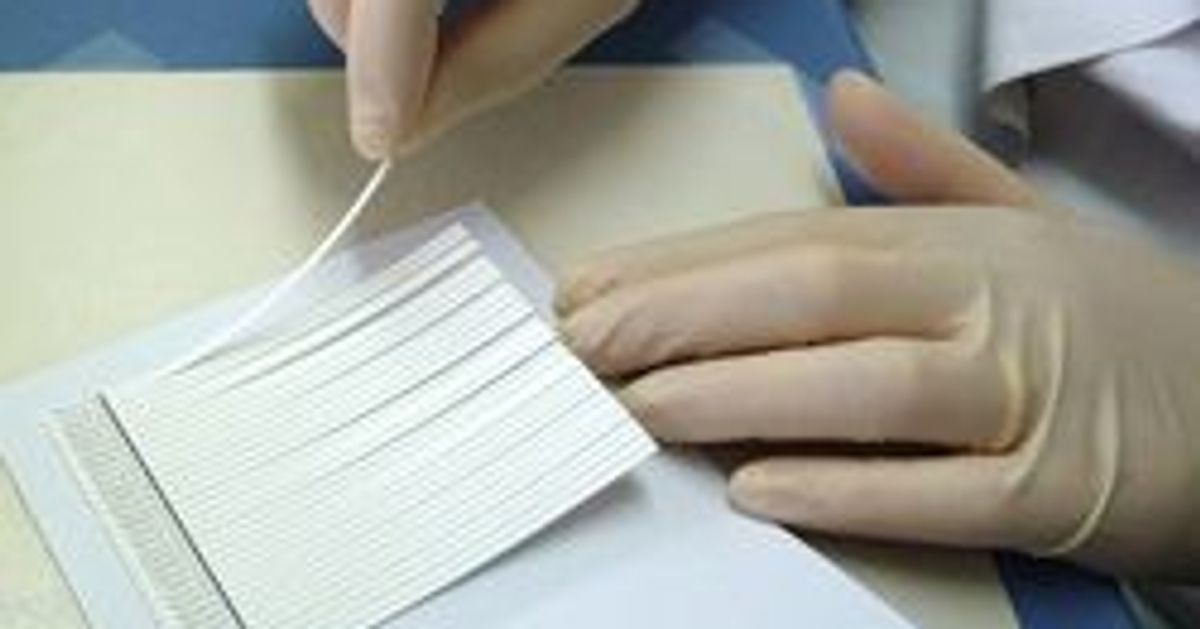 Enhance Lyme Disease Confirmation Testing With Line Immunossay Technology