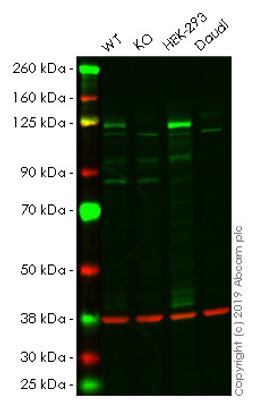 WB - DNMT3A knockout HeLa