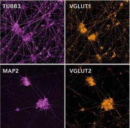 ioGlutamatergic Neurons form neuronal networks