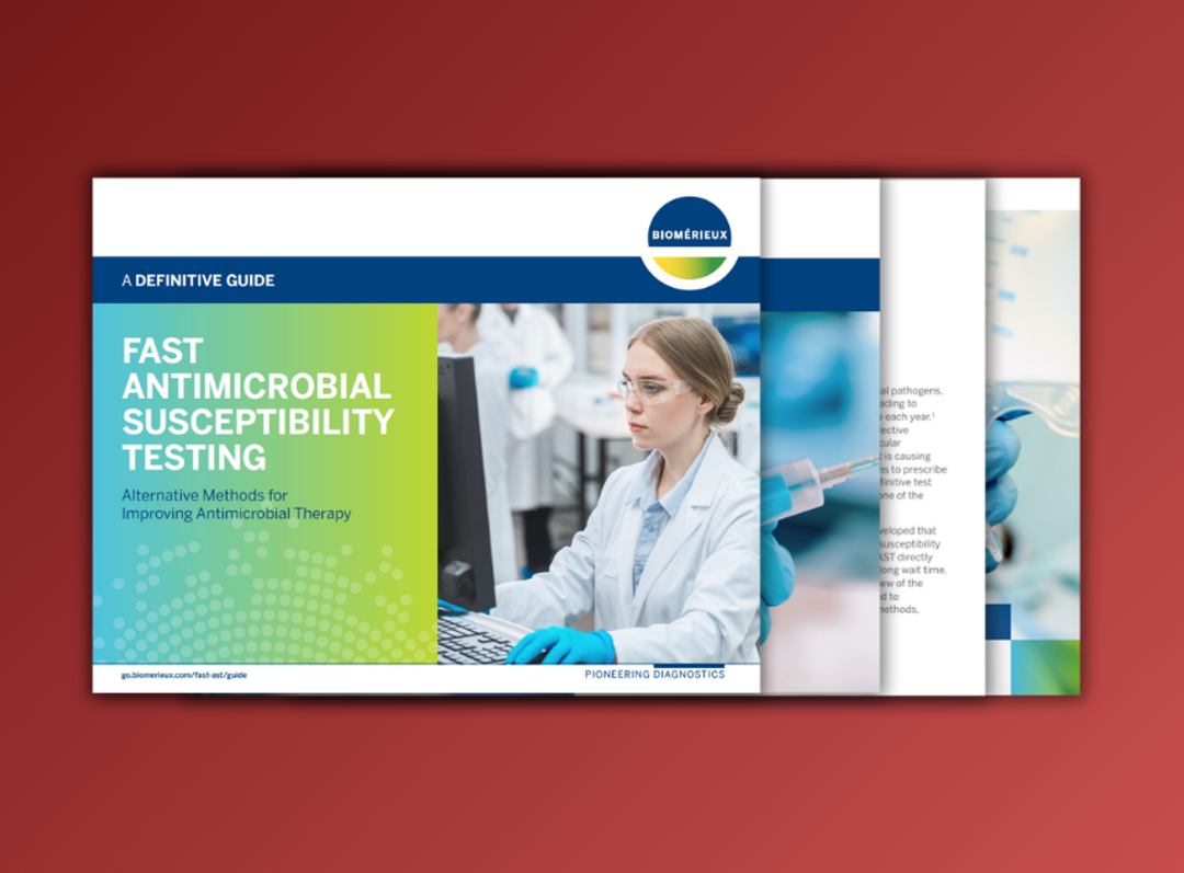 A guide to fast AST: Alternative methods for improving antimicrobial therapy