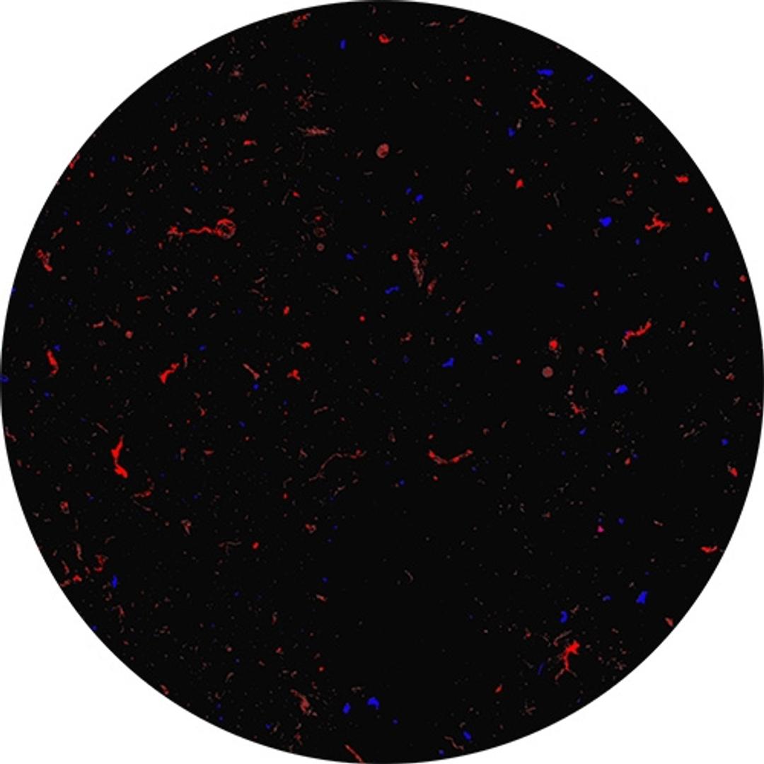 Protein (red) vs. other particles (blue)