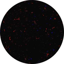 Protein (red) vs. other particles (blue)