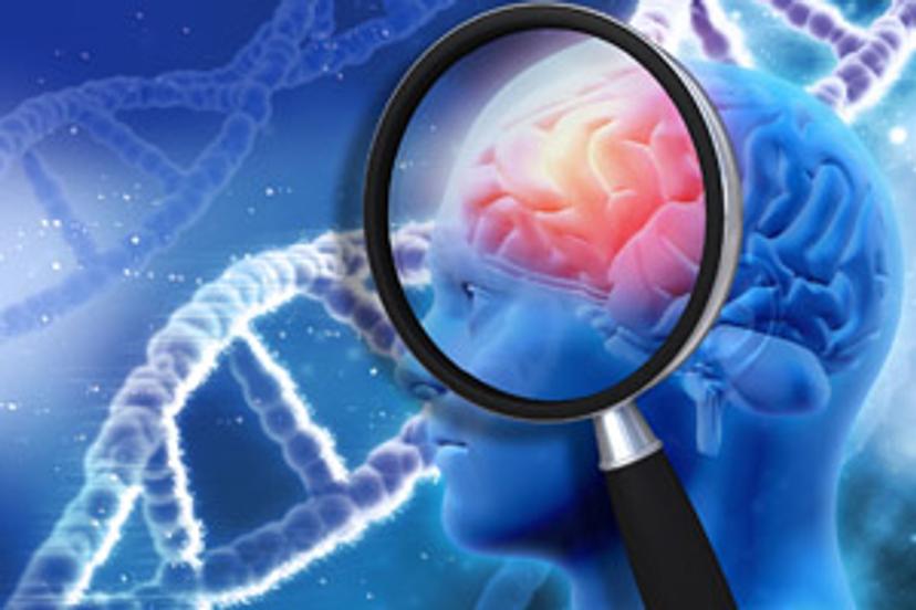 Neurofilament light chain (NfL) testing for neurodegenerative disease clinical trial programs 