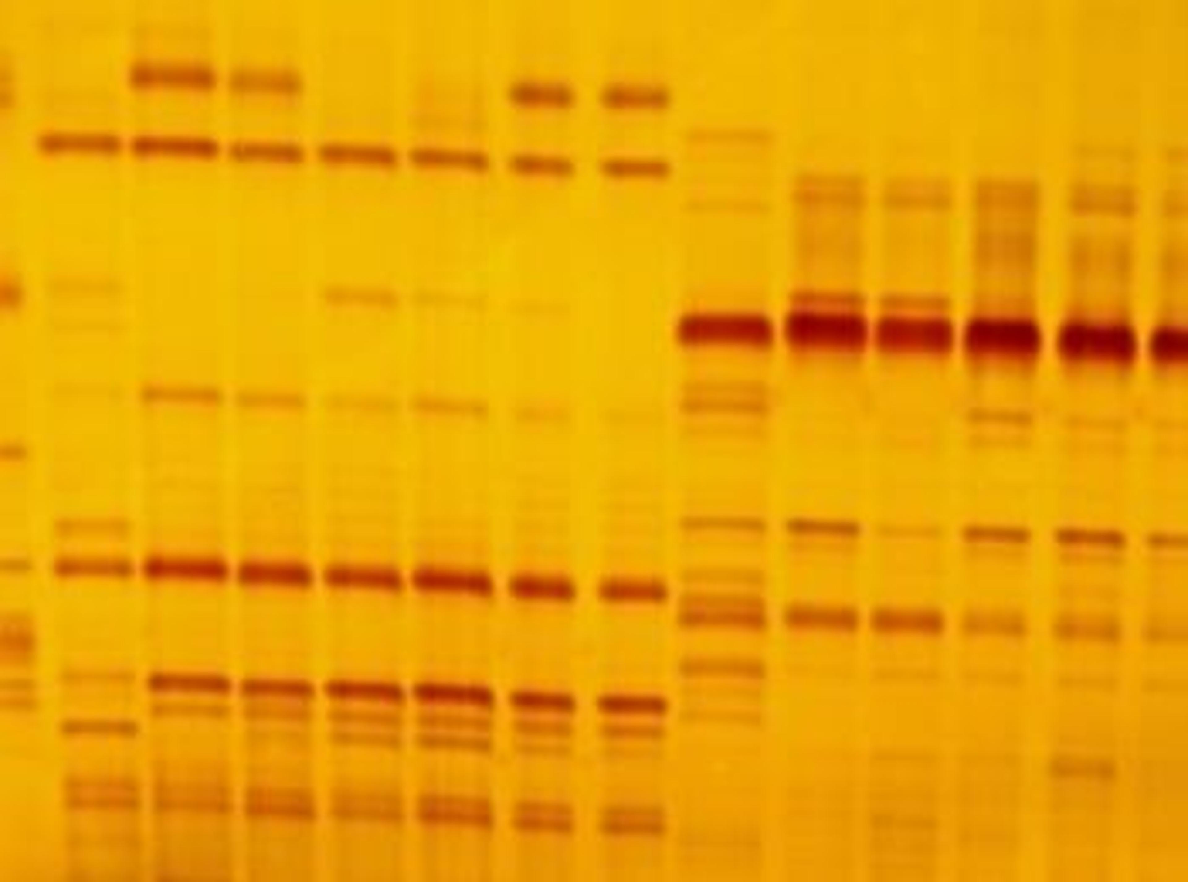 How to Buy PCR Technology