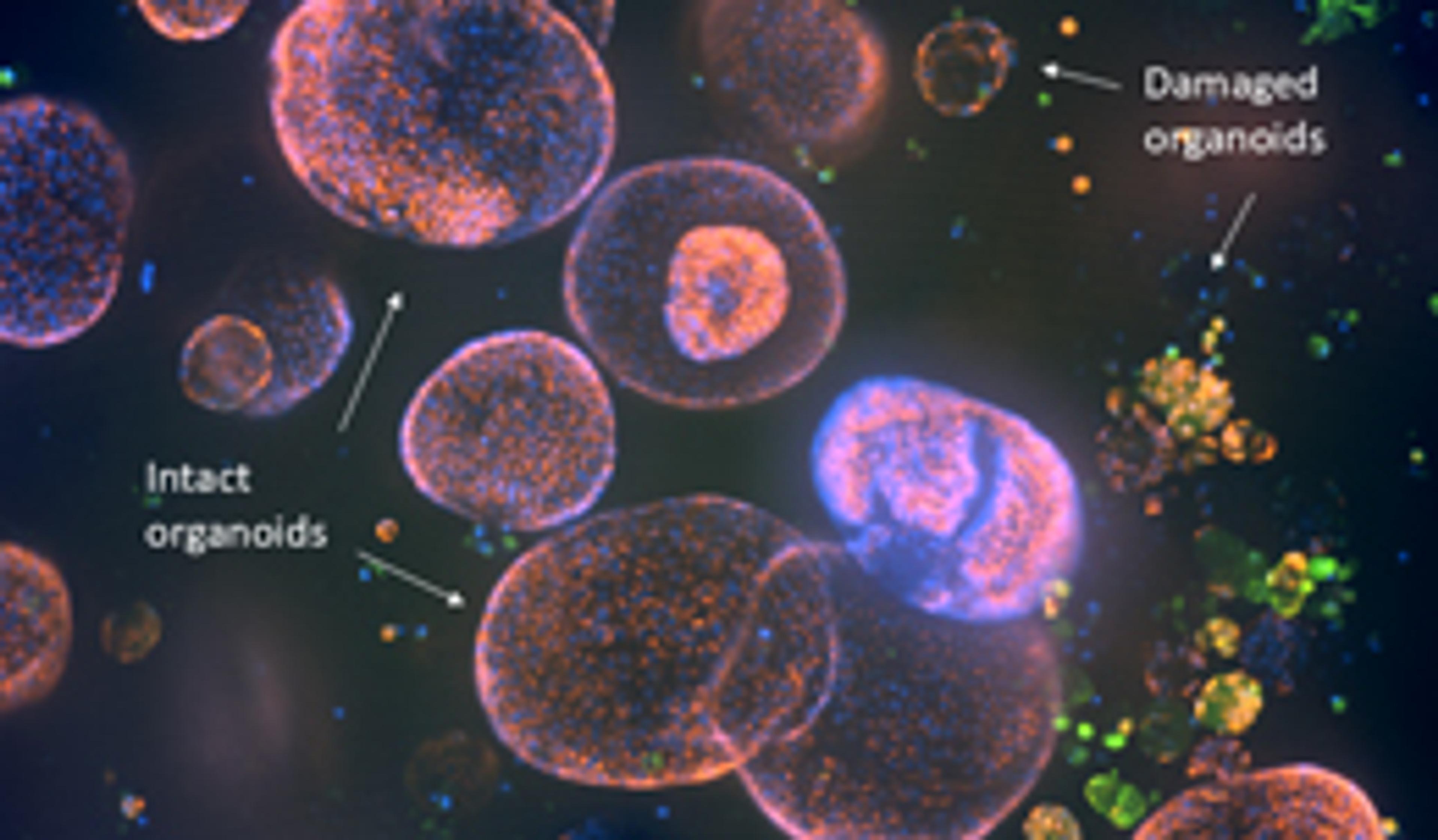 Automated cultivation and high-throughput screening of 3D cardiac organoids Automated cultivation and high-throughput screening of 3D cardiac organoids