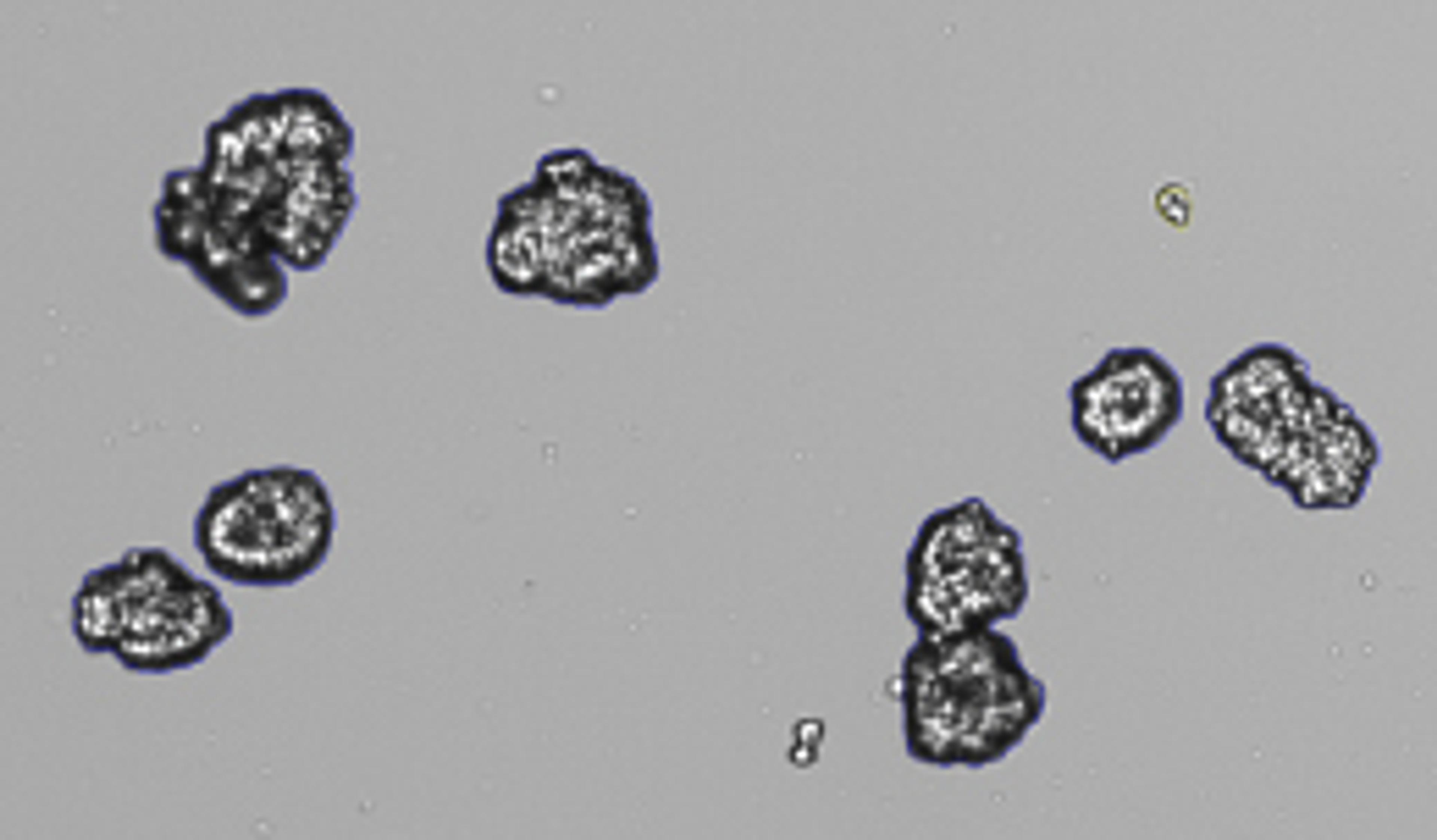 Overcome challenges in 3D cell culture analysis with automated organoid counting