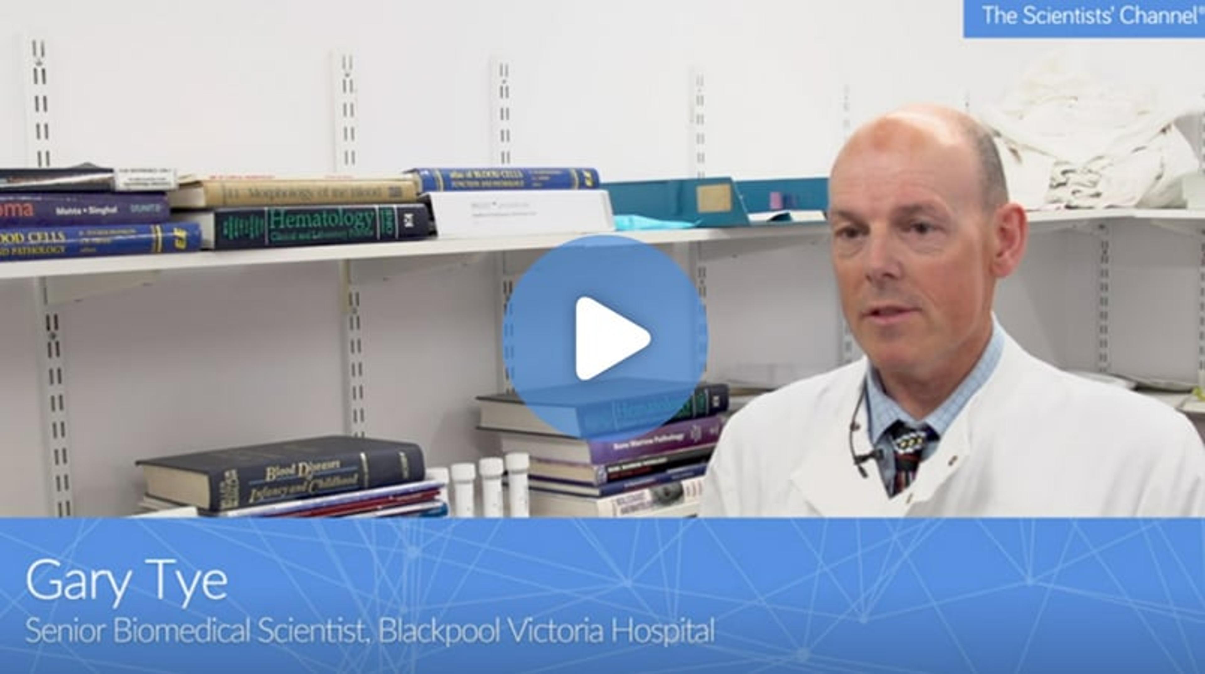 Accelerated hematological testing for improved patient care - Gary Tye Accelerated hematological testing for improved patient care - Gary Tye