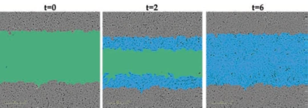 Observe tumor cell migration.