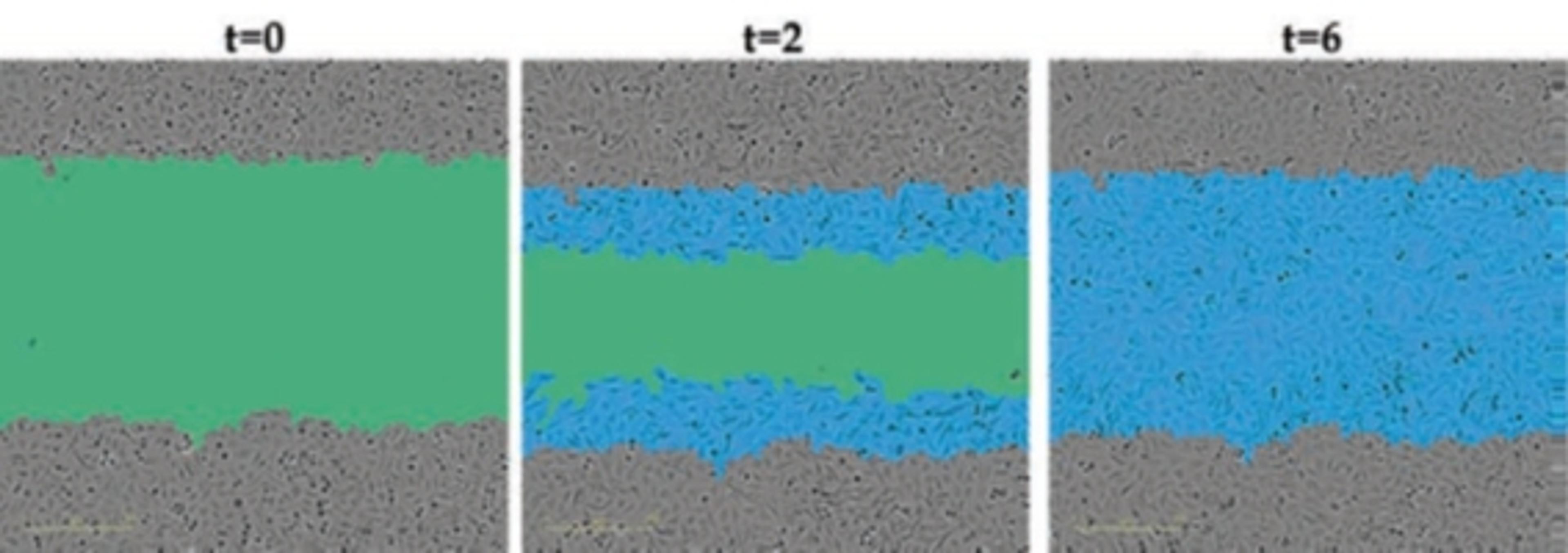 Observe tumor cell migration.