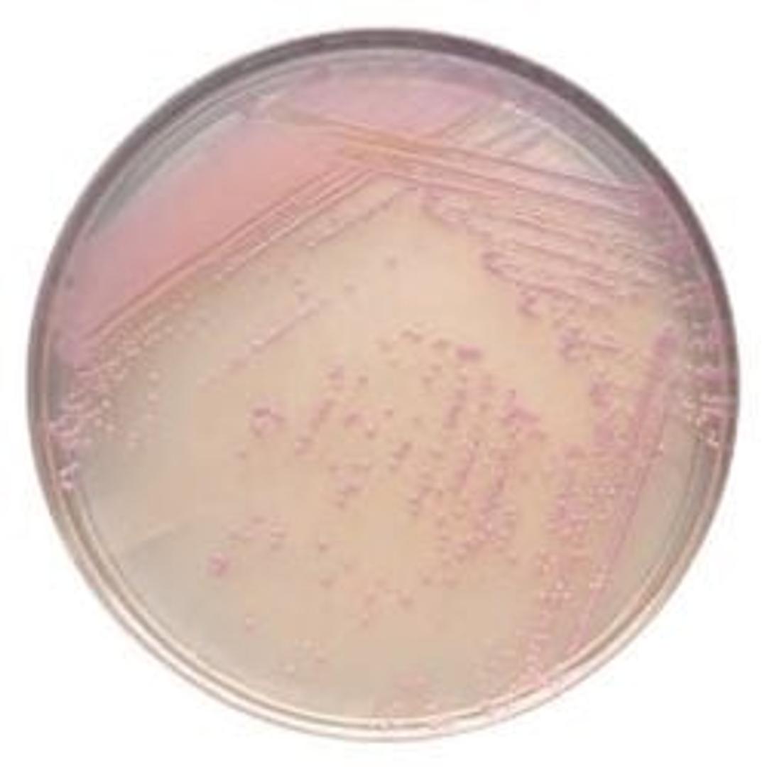 BD BBL™ CHROMagar™ Staph aureus Plate