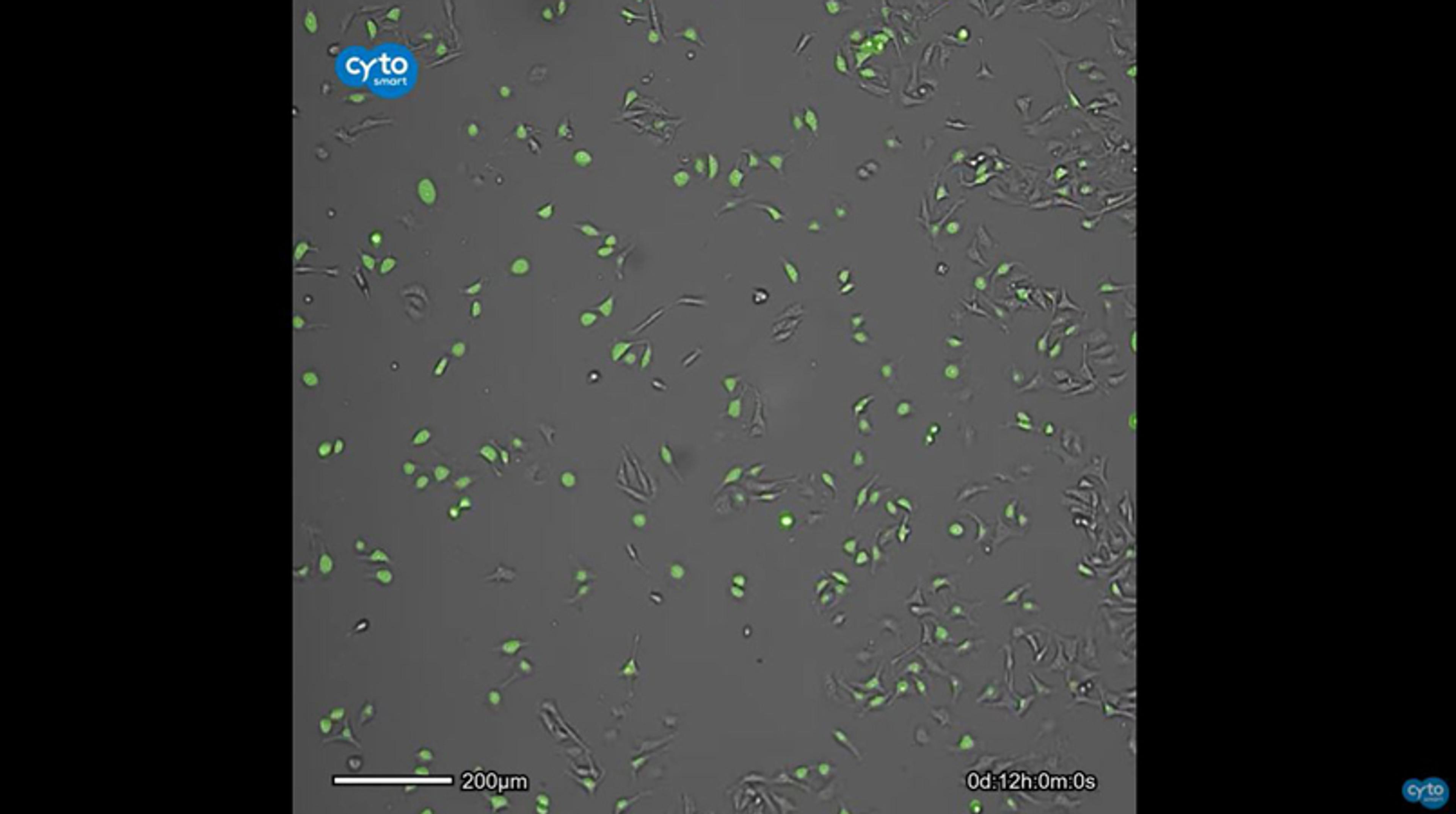 Time lapse of co-culture of HeLa cells together with 3T3 cells - CytoSMART Lux3 FL Time lapse of co-culture of HeLa cells together with 3T3 cells - CytoSMART Lux3 FL