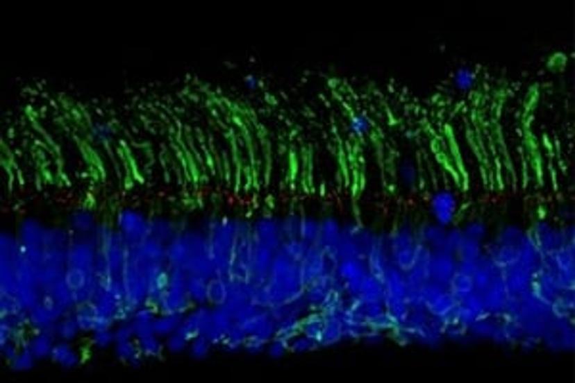 Collaboration and CRISPR tools move scientists closer to a cure for sight loss  