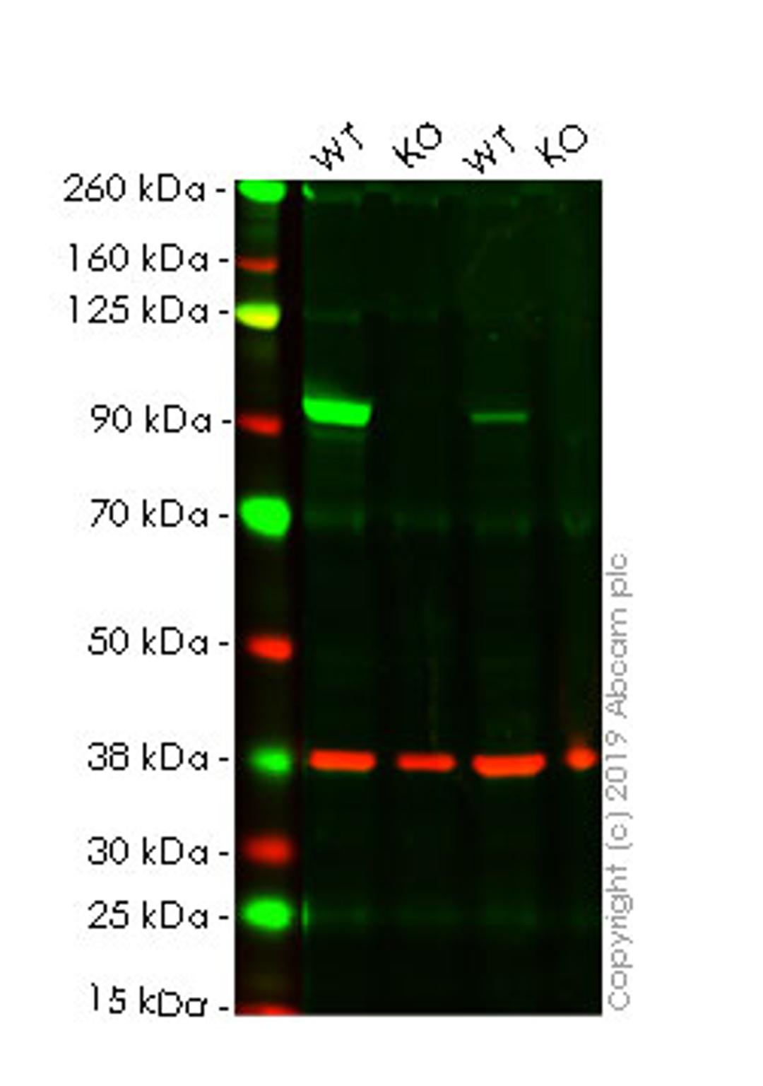 WB - CTNNB1 knockout HeLa