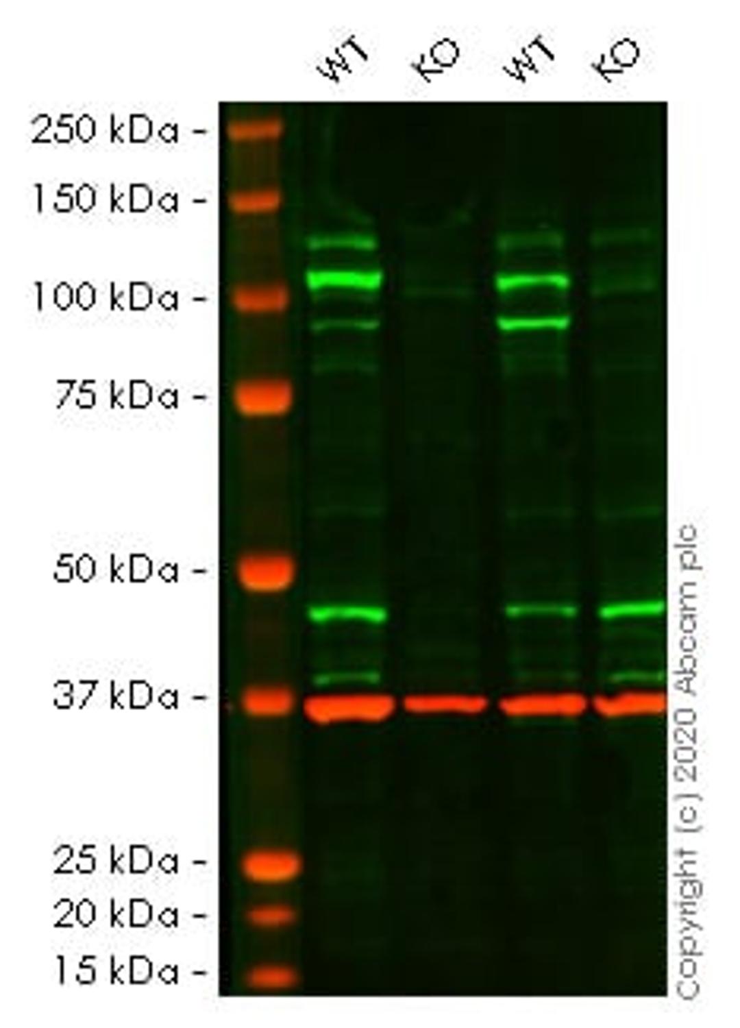 WB - STAT2 knockout HeLa