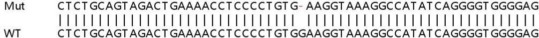 Sanger Seq - ATP2B4 knockout HeLa