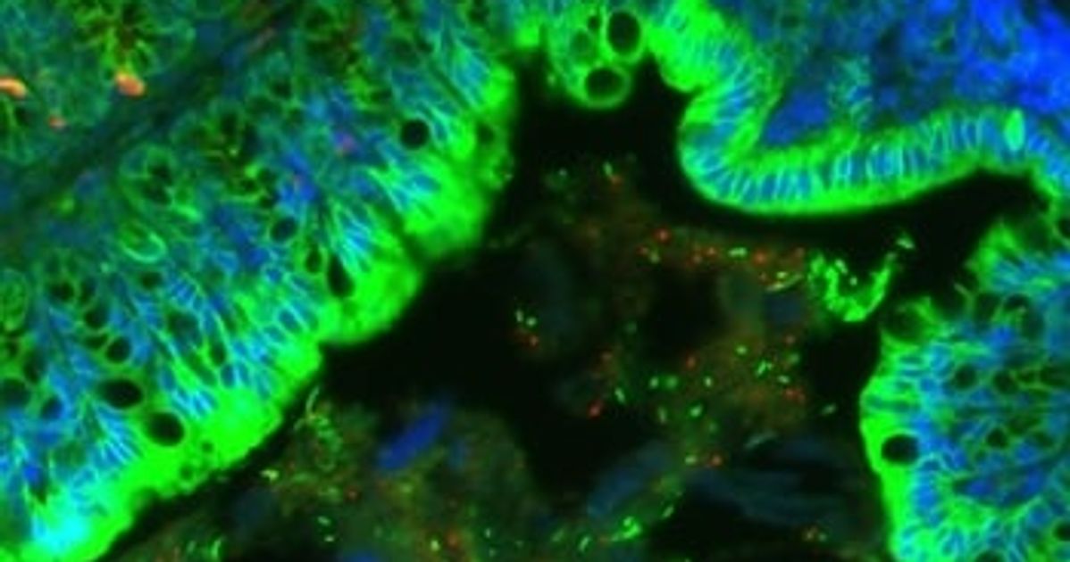 The Diet Bacteria: Why we are what our microbes eat