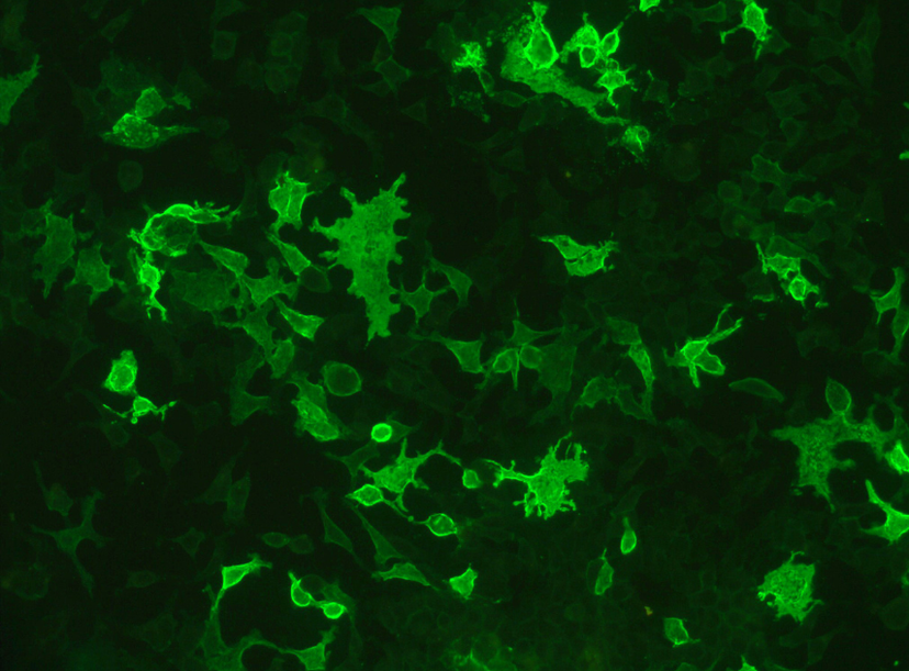 AQP-4 cell-based assay