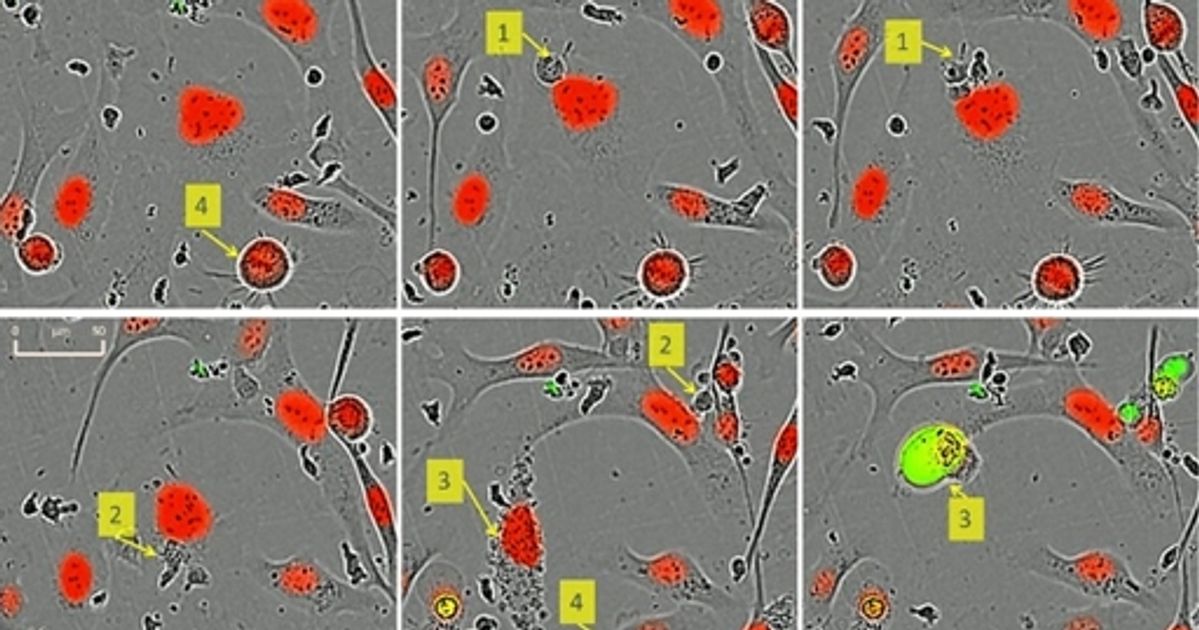 Incucyte® Immuno-Oncology Assays | SelectScience