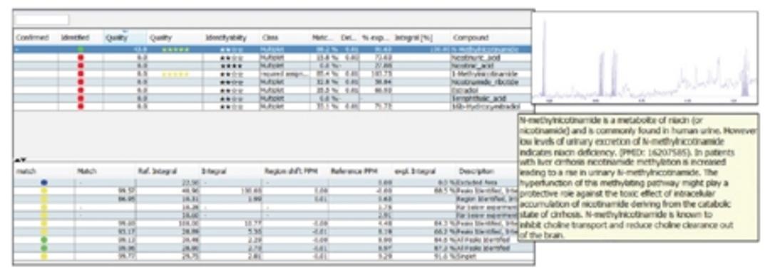 AssureNMR match of a human urine spectrum using HMDB.