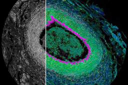 Histological section from cat eye