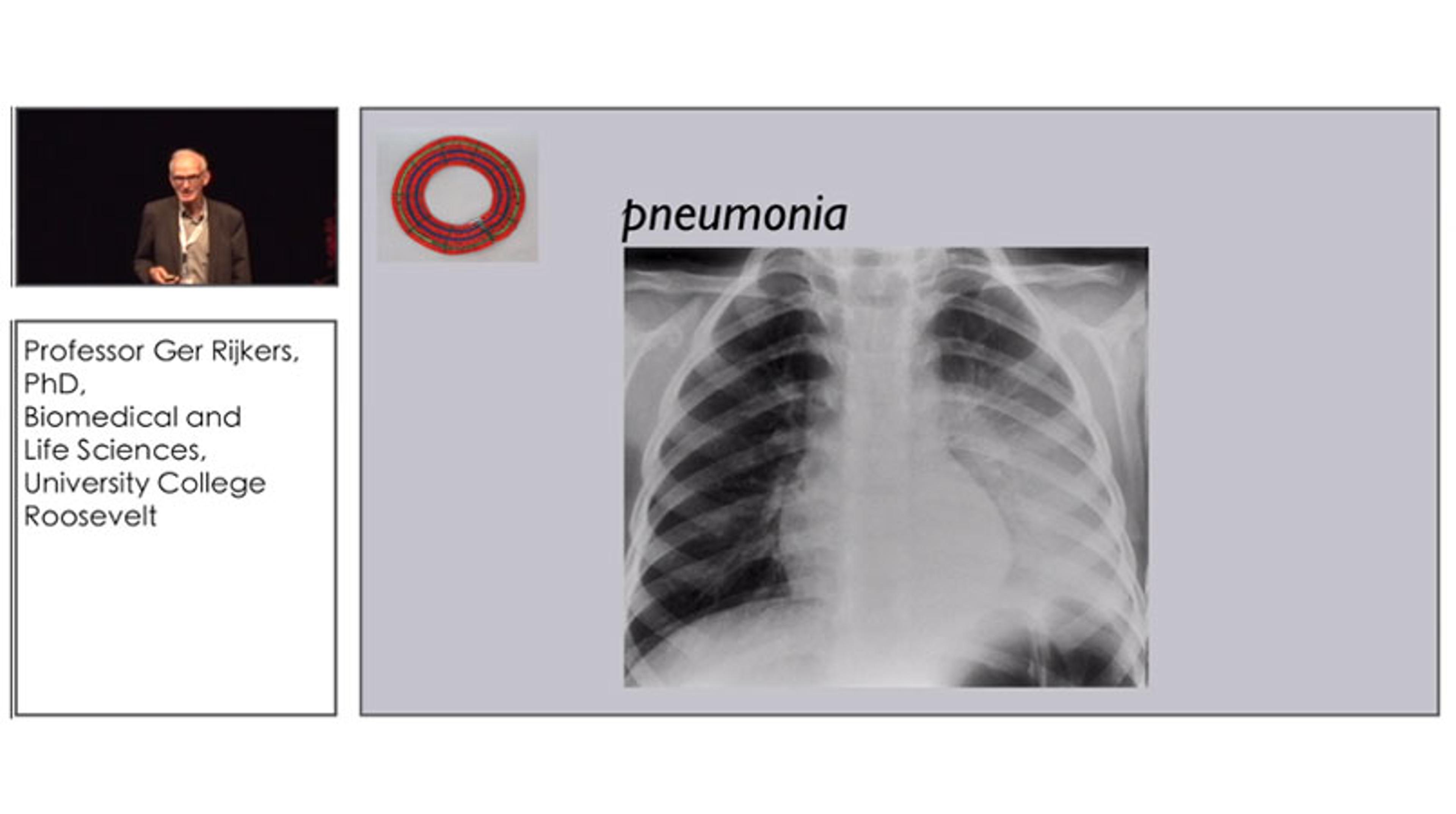 Taking Steps Towards Discriminating all Pneumococcal Serotypes with Multiplex Serology Taking Steps Towards Discriminating all Pneumococcal Serotypes with Multiplex Serology