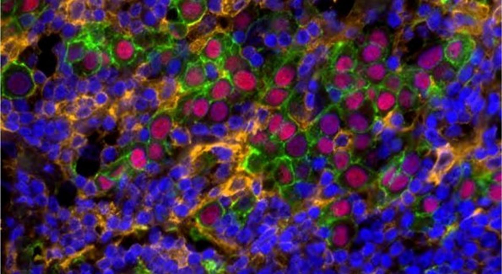 Harvard glyco-immuno oncology