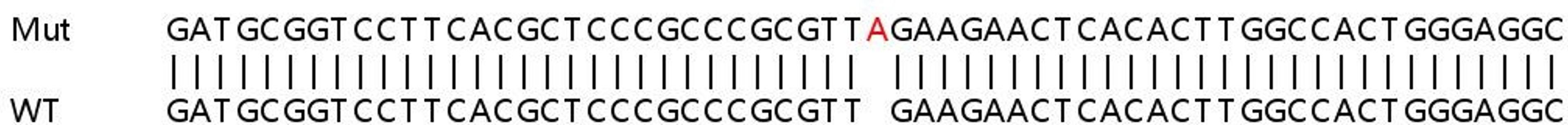 Sanger Seq - CBS knockout HeLa