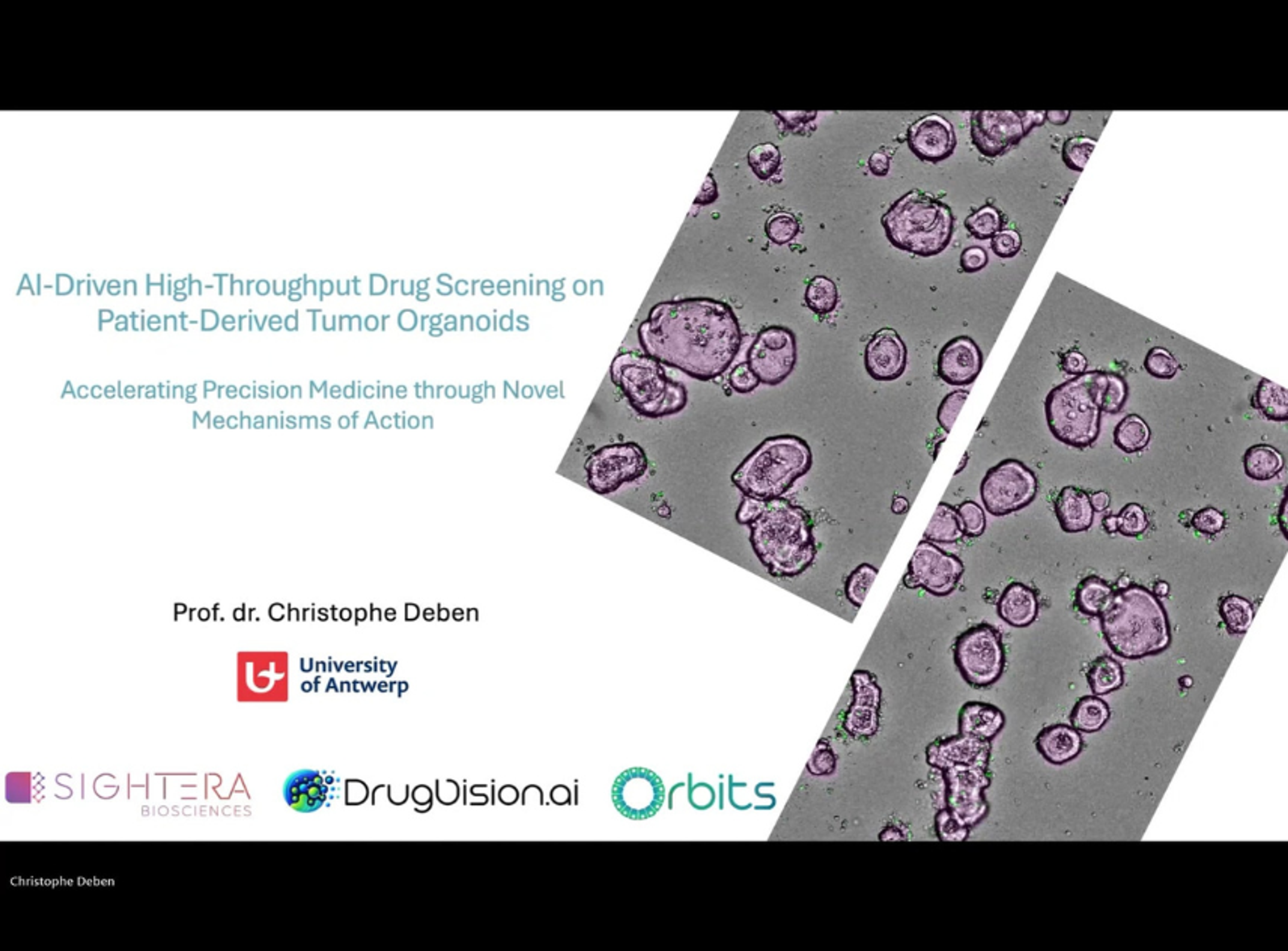 AI-driven high-throughput drug screening on patient-derived tumor organoids AI-driven high-throughput drug screening on patient-derived tumor organoids