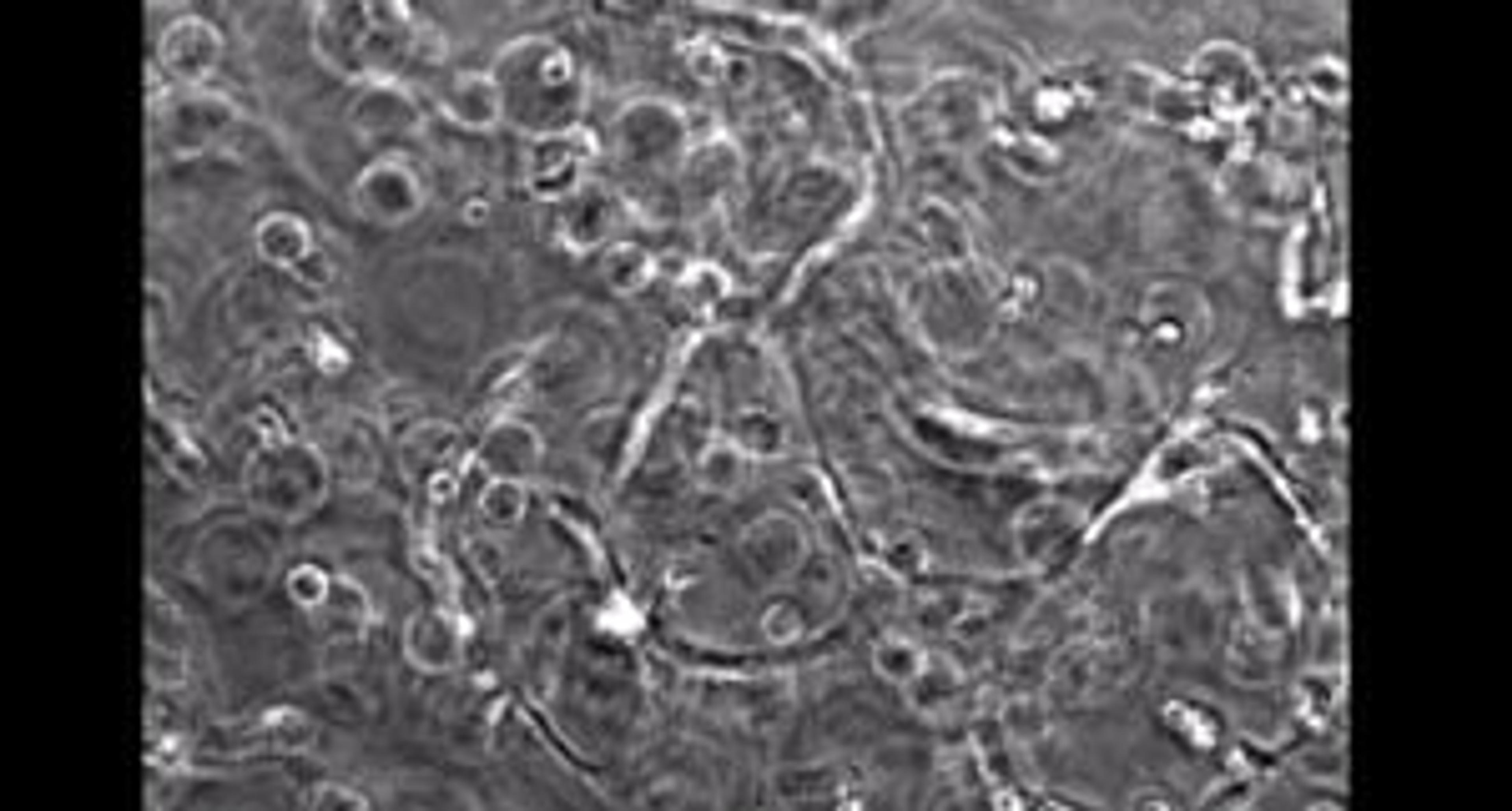 Cellular Dynamics: Capillary-like Network Formation of iCell® Endothelial Cells in PEG Hydrogel Cellular Dynamics: Capillary-like Network Formation of iCell® Endothelial Cells in PEG Hydrogel