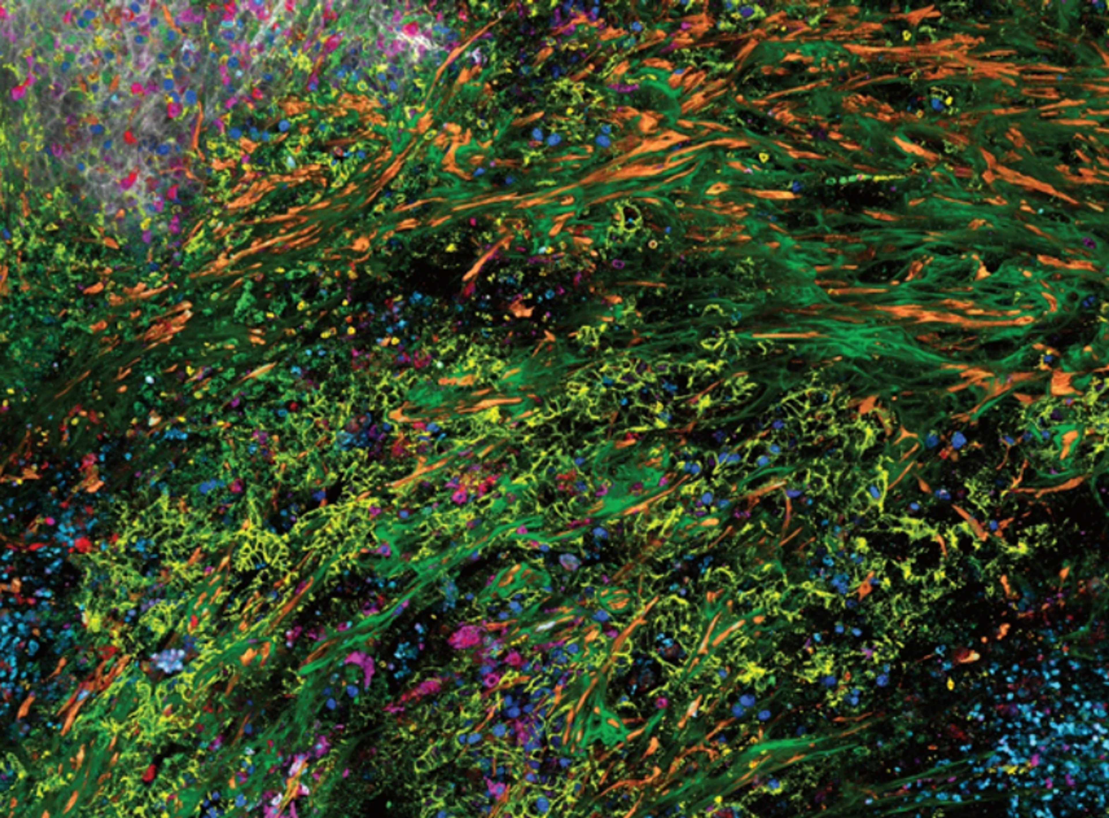 Overview of a pancreatic tumor section (1.8 x 0.8 mm) in a mouse model, labeled with 15 markers and imaged in one pass using STELLARIS with SpectraPlex 3D high-multiplex imaging in cancer immunology.