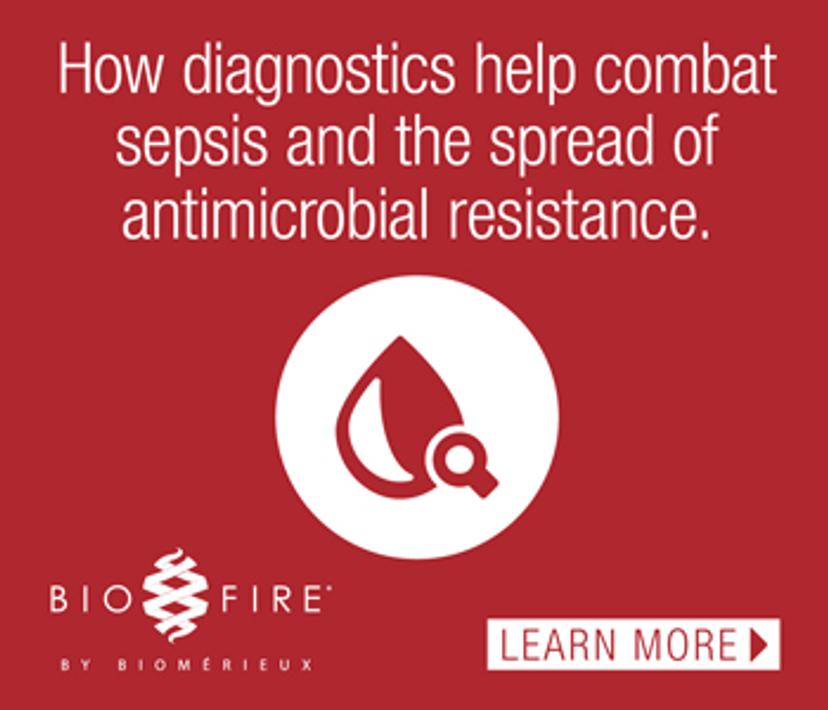 How diagnostics help combat sepsis and the spread of antimicrobial resistance