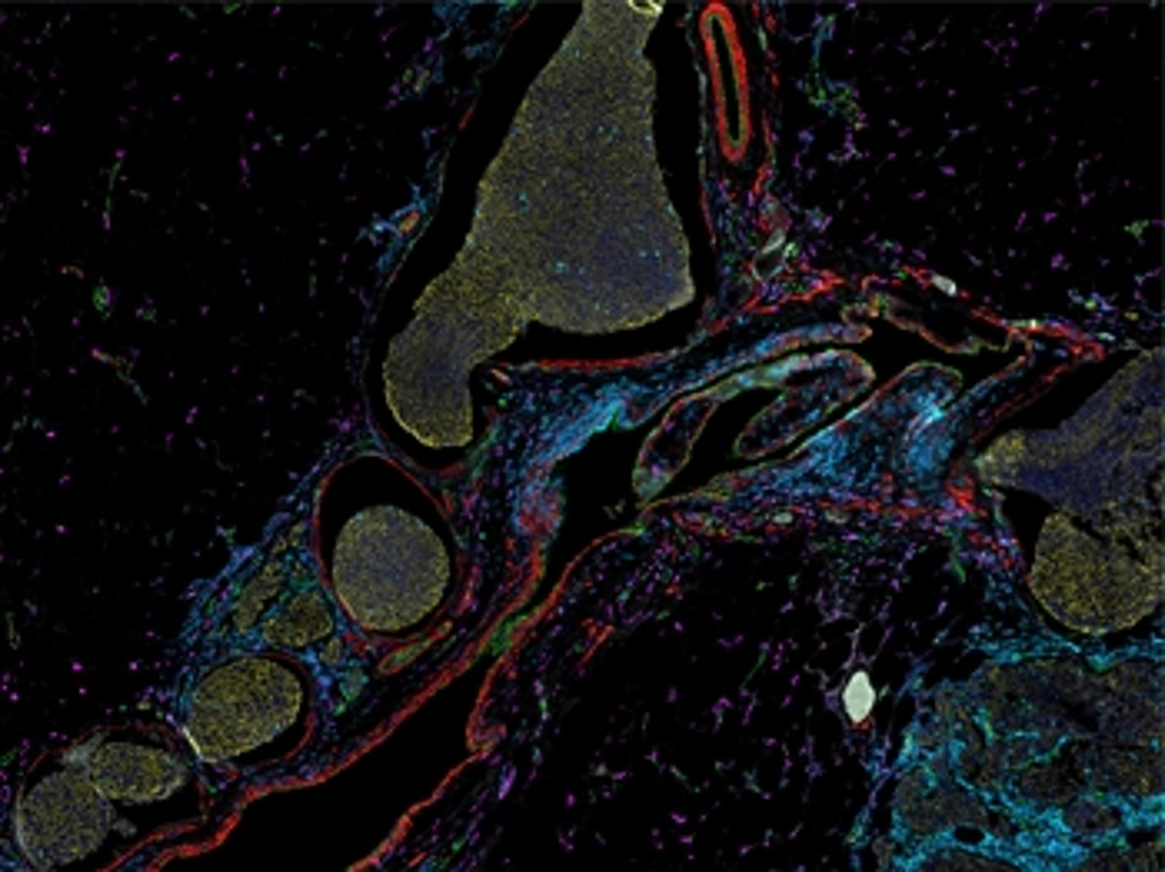 Quantitative microscopy for precision spatial biology: “From samples to knowledge”