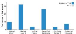 Comparison of RNA recovery from FFPE tissues.