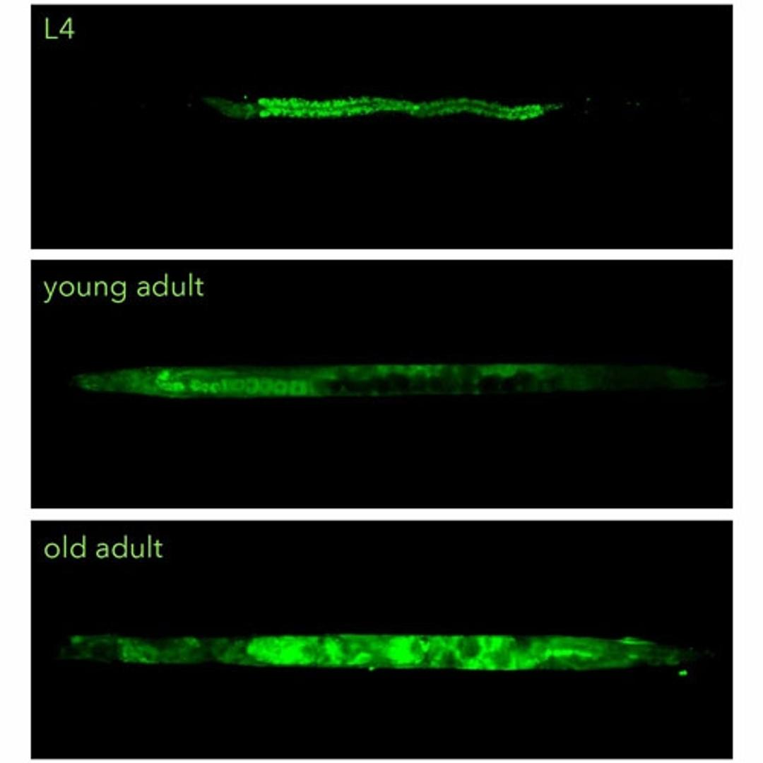 RediStainTM WormDye Lipid stain for worms at three ages