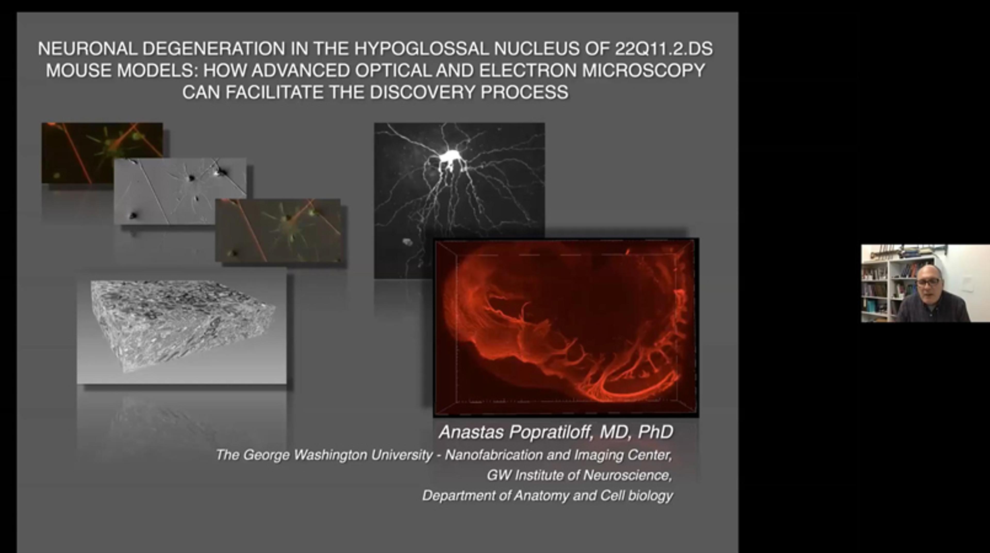 Neuronal degeneration in the hypoglossal nucleus of 22Q11.2.DS mouse models Neuronal degeneration in the hypoglossal nucleus of 22Q11.2.DS mouse models